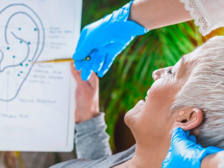 Patientin erhält Akupunktur zur Unterstützung des seelischen Wohlbefindens bei psychischen Erkrankungen in der Praxis Yildiran Hannover