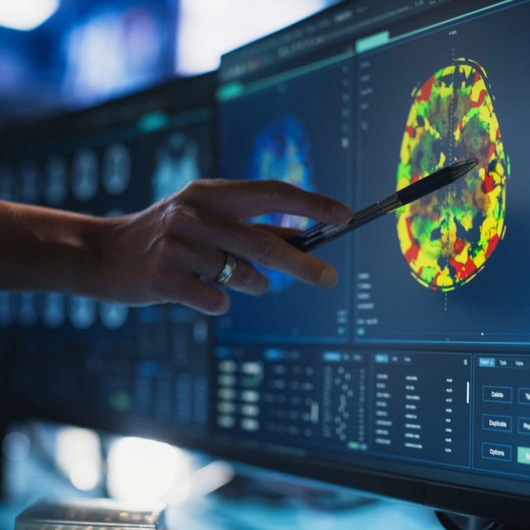 Neurologie Hannover – Schlaganfall, Parkinson & Migräneversorgung Neurologische Diagnostik und Therapie in Hannover – Behandlung von Schlaganfall, Parkinson, Migräne und Bewegungsstörungen